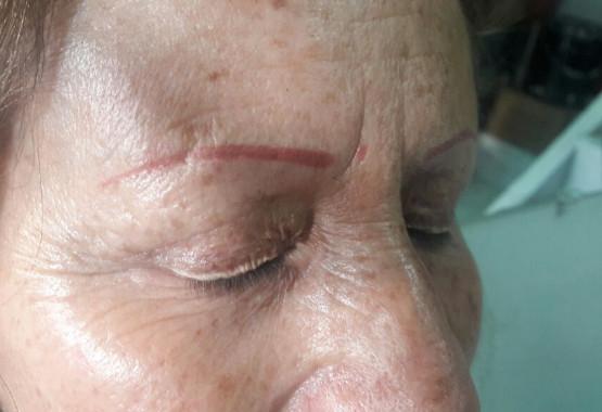 Permanent Makeup Risks and Complications
