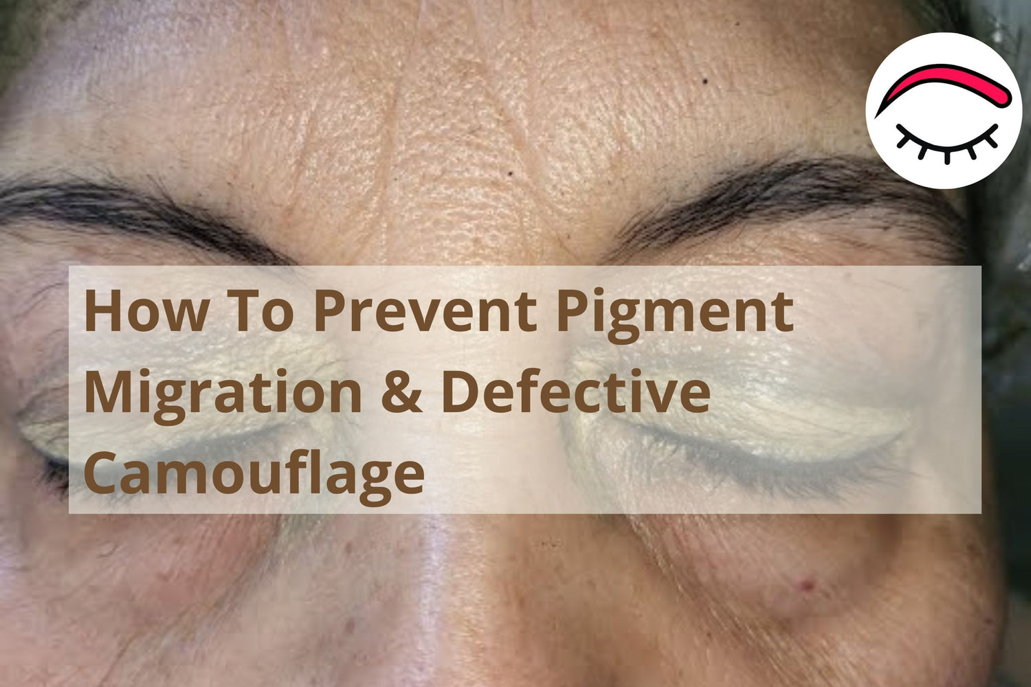 How To Prevent Pigment Migration & Defective Camouflage
