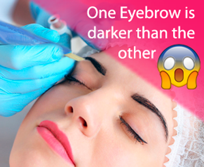 What if one eyebrow looks darker than the other after the procedure?